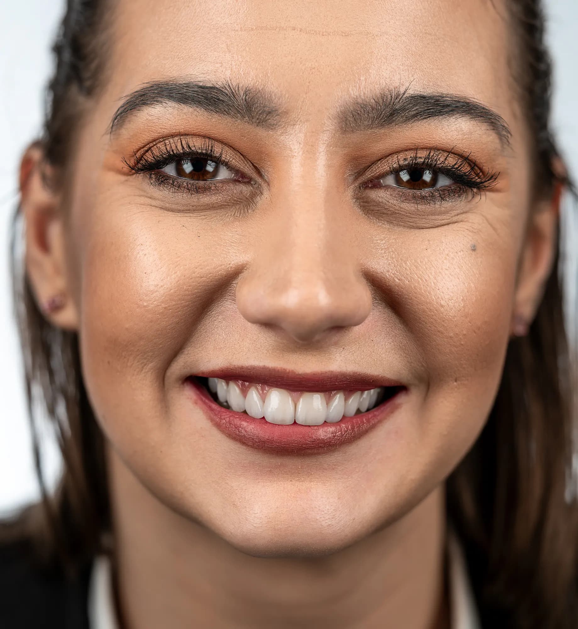 Implants for missing teeth, gum contouring and composites