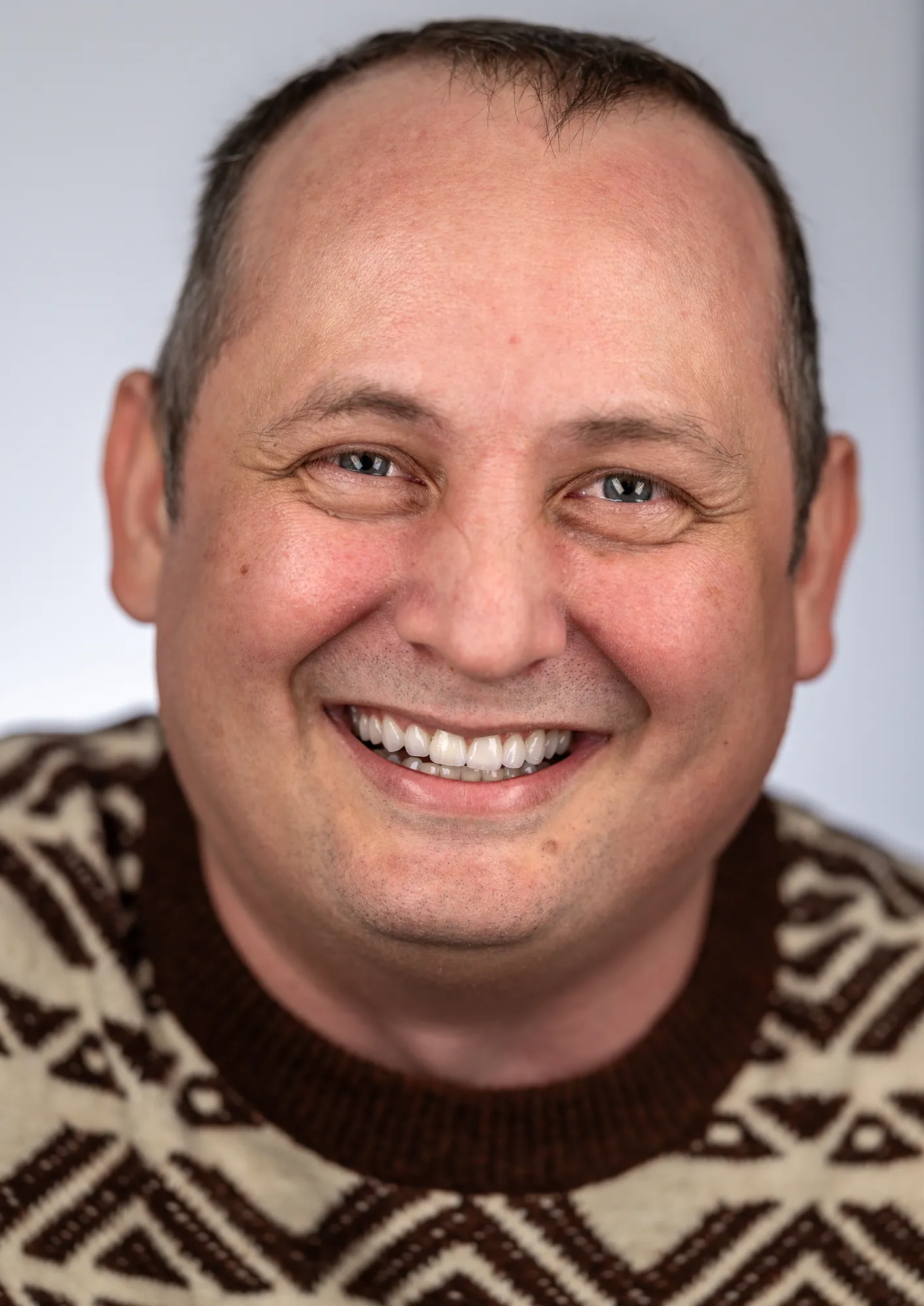 Failing front teeth replaced: orthodontics, implants and grafts
