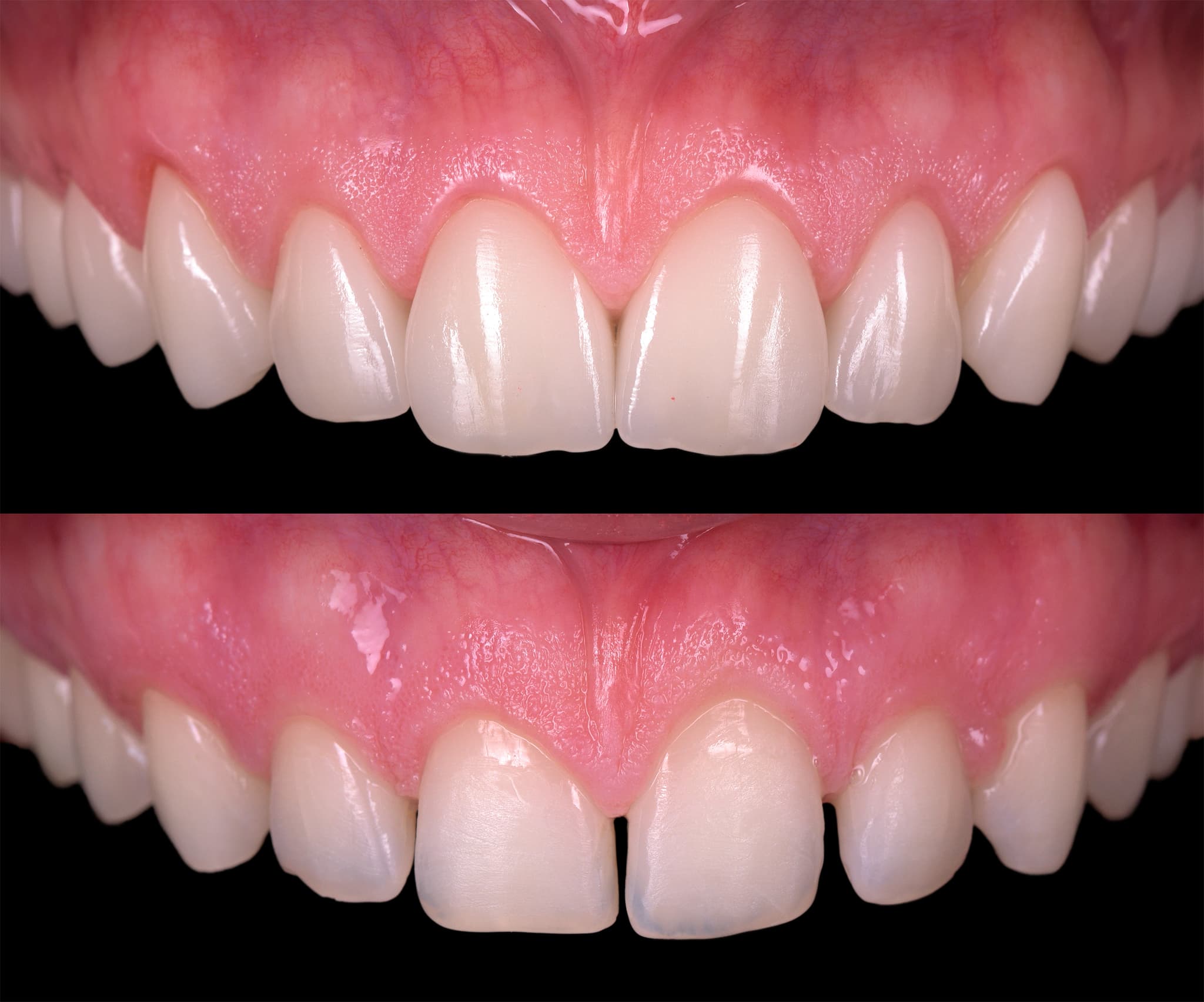 gingie before and after