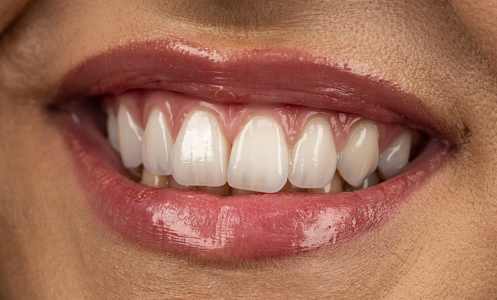 L1000595-Enhanced-NR-1