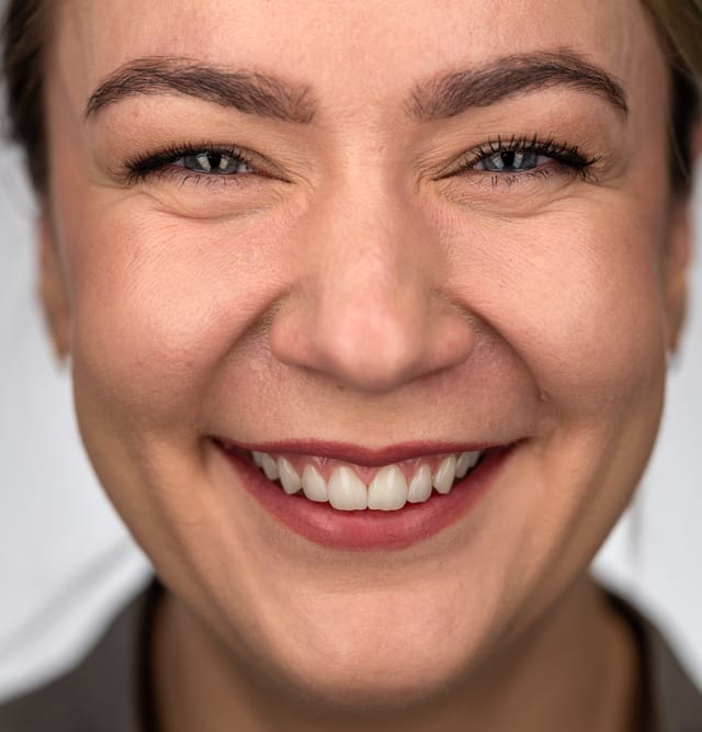 Frontal image showing soft proportions, balanced gingival architecture, and childlike smile expression.