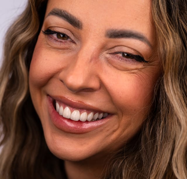 Before and after smile showing improved gum contour, veneers, and central crown replacement