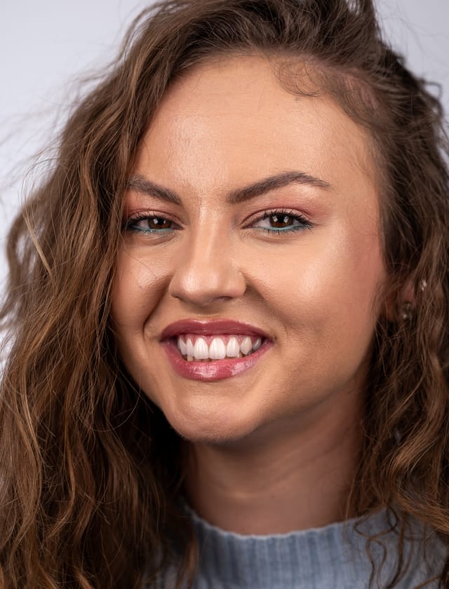 Frontal image showing natural smile with refined tooth shapes and preserved structure.